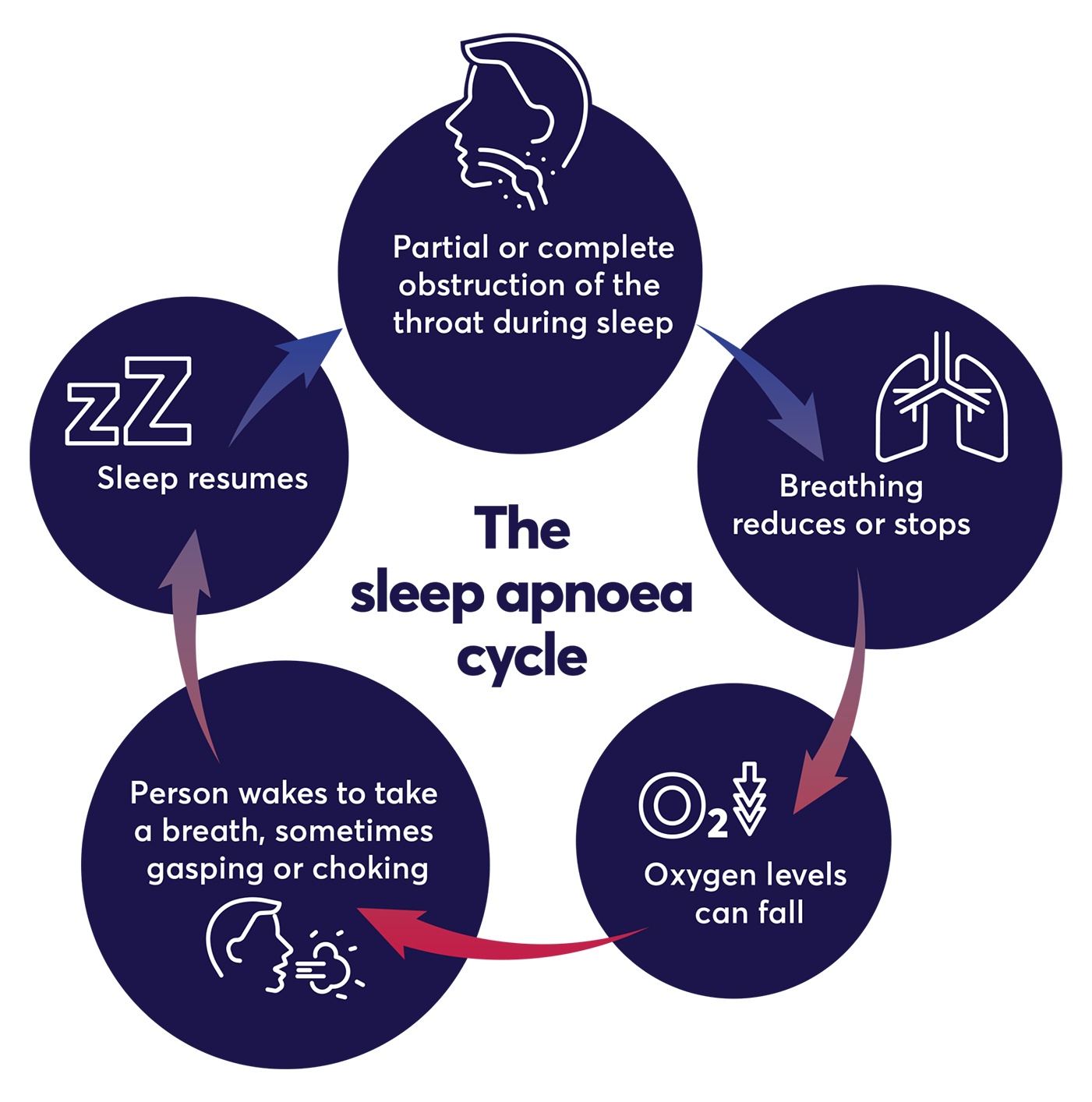 A Guide To Sleep Apnoea: The Causes, Types And Treatment